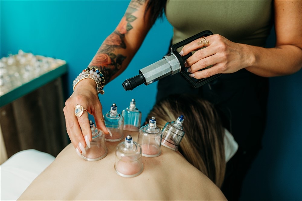 Christina placing cups during a cupping treatment