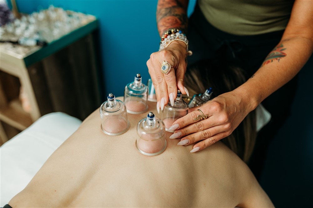 Cupping therapy at Vitality Wellness