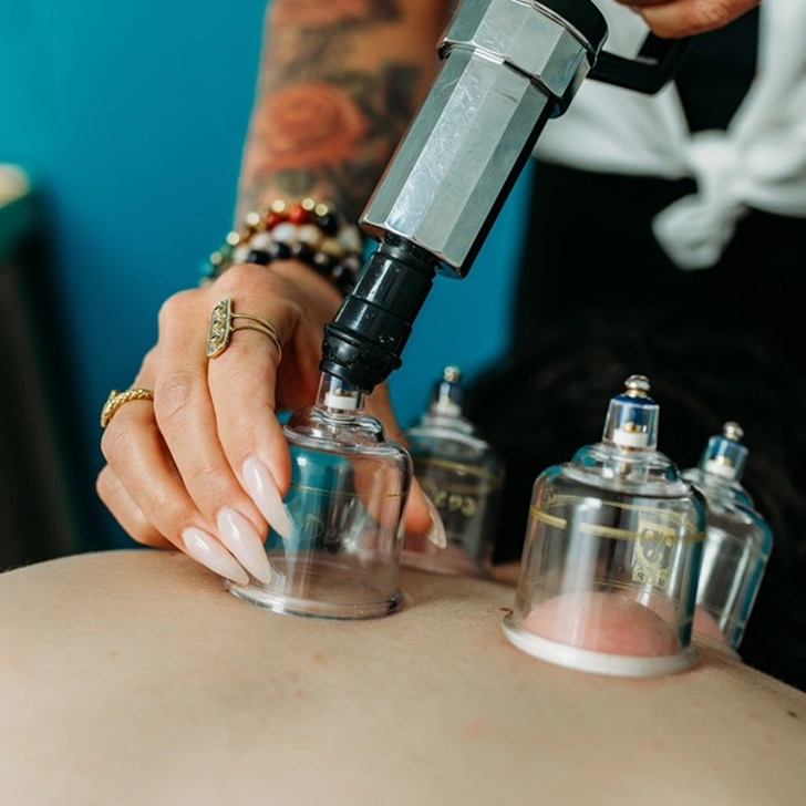 Christina Dwyer at Vitality Wellness in Park Ridge, Illinois Cupping Suction