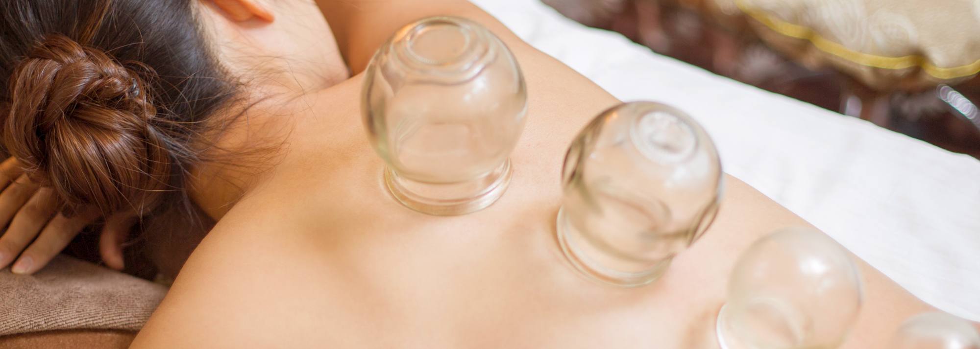 Cupping Therapy